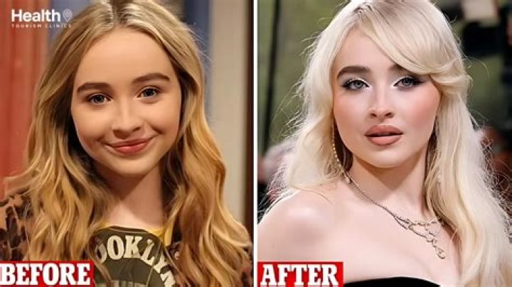 Has Sabrina Carpenter Undergone Plastic Surgery? Exploring The Truth Behind The Rumors