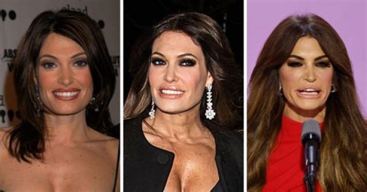 Kimberly Guilfoyle's Astonishing Transformation: Before And After