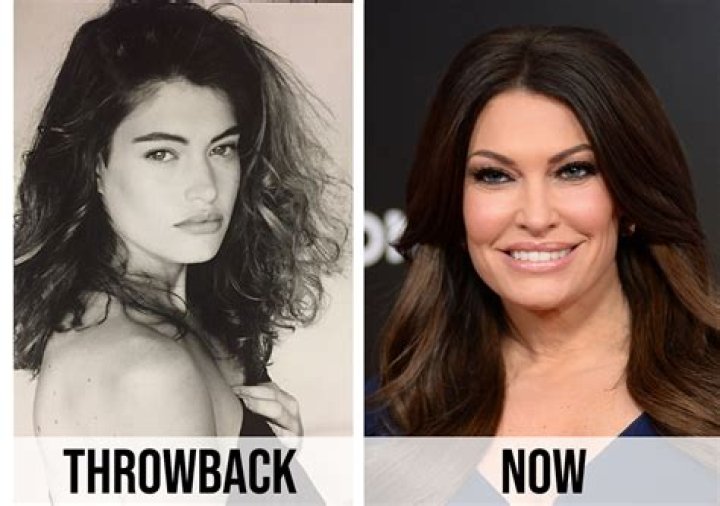 The Ultimate Guide To Kimberly Guilfoyle's Plastic Surgery Procedures