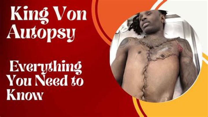Unveiling The Truth: King Von Autopsy P Explained